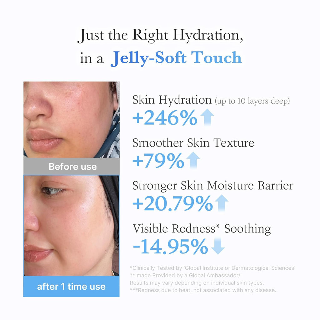 Jelly Cream with Hyaluronic Acid | Daily Moisturizer for All Skin Types | Long-Lasting Hydration with Hyaluronic Acid, Ceramides, Multi Peptides | Supports Skin'S Natural Barrier | 1.69 Fl.Oz